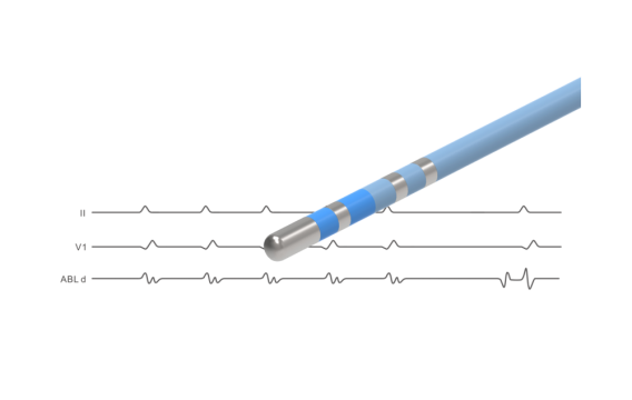 NAVABLATOR? 心臟<font color=red>射頻消融</font>導(dǎo)管