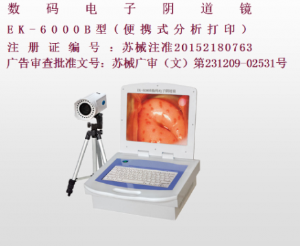 億康盈聯(lián)數(shù)碼電子陰道鏡（彩色液晶分析打?。〦K-6000B