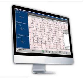 動(dòng)態(tài)心電圖分析系統(tǒng)Cardio 8000 
