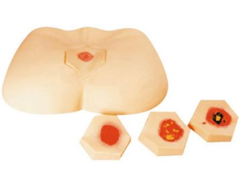 <font color=red>階段褥瘡護(hù)理模型</font>KAS-RC-3