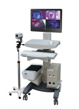 聯(lián)創(chuàng)數(shù)碼陰道鏡(熒光款)LC-9100C 