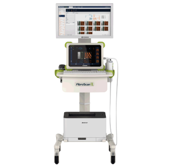 回波肝臟瞬時(shí)彈性檢測儀fibroscan Q