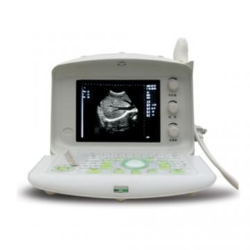 凱爾便攜式全數(shù)字B超機(jī)KR-1288V