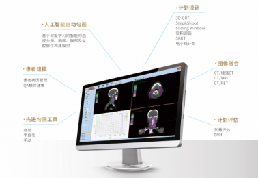三維放射治療計劃系統(tǒng)的原理|特點(diǎn)解析