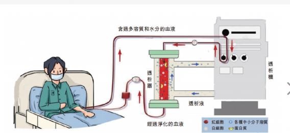 了解血液透析機的原理和結(jié)構(gòu)-朗逸器械百科