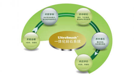安和UltraSmashTM一體化碎石清石系統(tǒng)?與EMS產(chǎn)品的對比